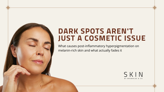 Dark Spots on Melanin-Rich Skin: Why They Happen and How to Actually Fade Them