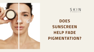 Does Sunscreen Help Fade Pigmentation? Why SPF Is Essential for Dark Spots