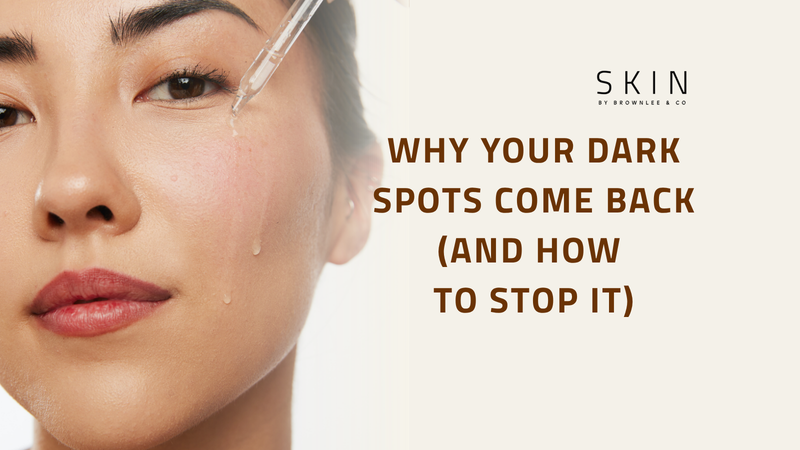 Why Your Dark Spots Come Back (And How to Stop It)
