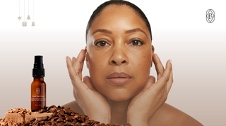 You Have to Treat the Acne Before the Hyperpigmentation