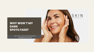 Why Won’t My Dark Spots Fade? Understanding and Treating Persistent Hyperpigmentation