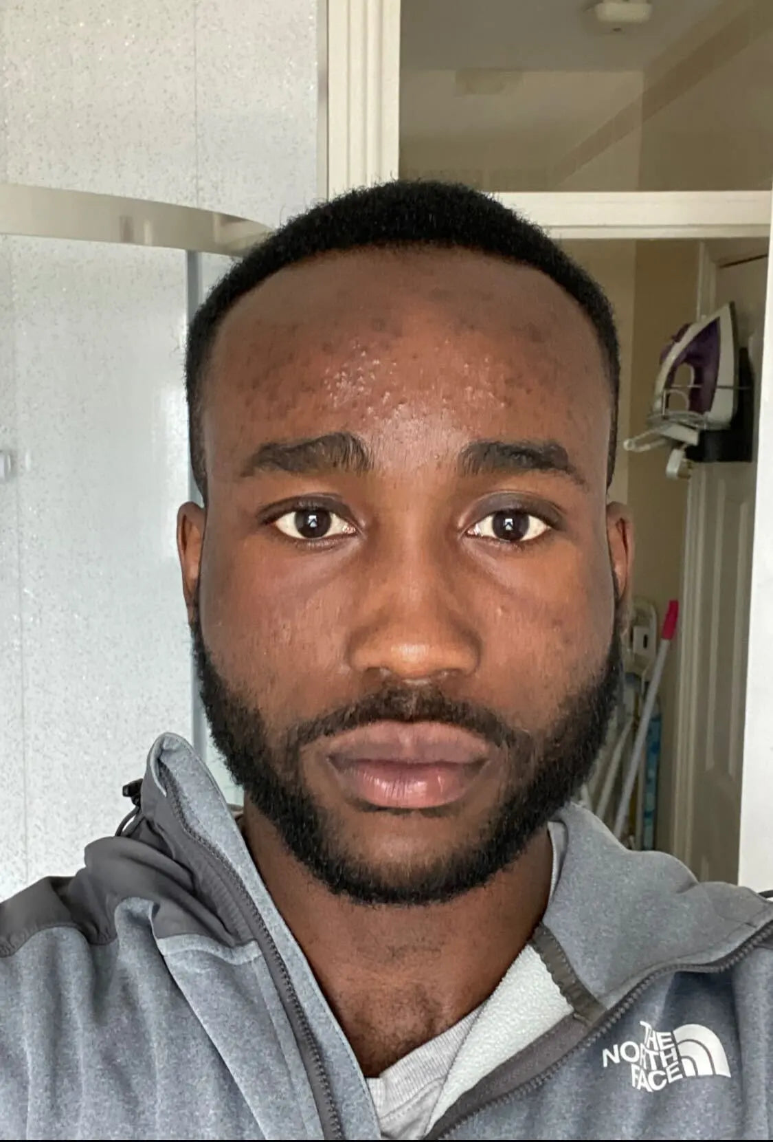 Transforming Skin: A Remarkable Boy's Journey

Witness the incredible transformation of a young man's skin through consistent skincare. From [mention specific skin concern, e.g., persistent acne] to a radiant, healthy glow, this before-and-after showcases the power of proper routines.