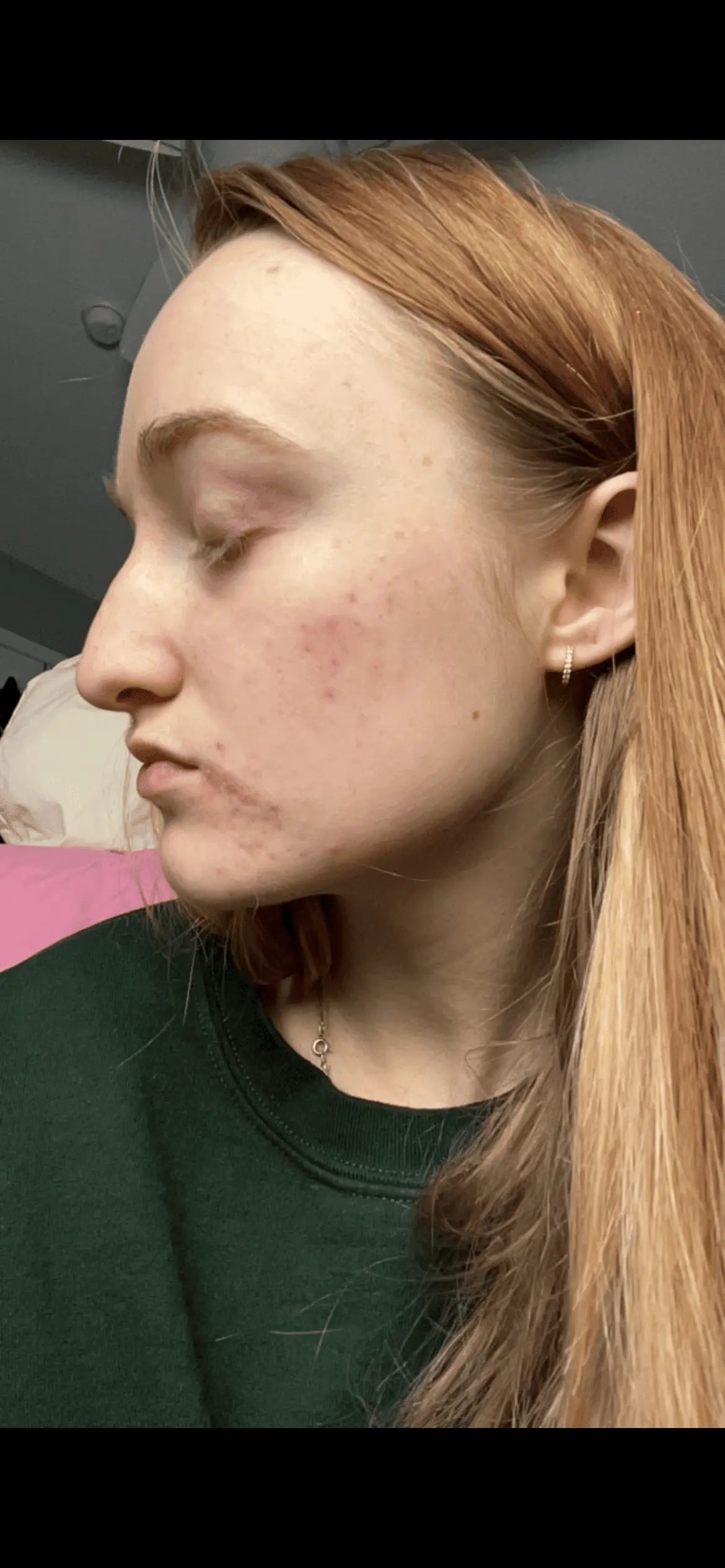 Transform Your Skin: Witness the Power of Our Skincare

See the remarkable difference our skincare products can make. Experience visible improvements in skin texture, tone, and overall radiance. Discover the secrets to a healthier, more youthful complexion.