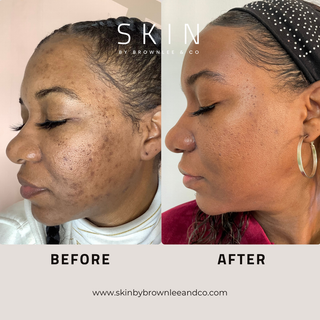 Radiant Renewal Glycolic Serum - Glycolic Acid Exfoliating Treatment | Wholesale
