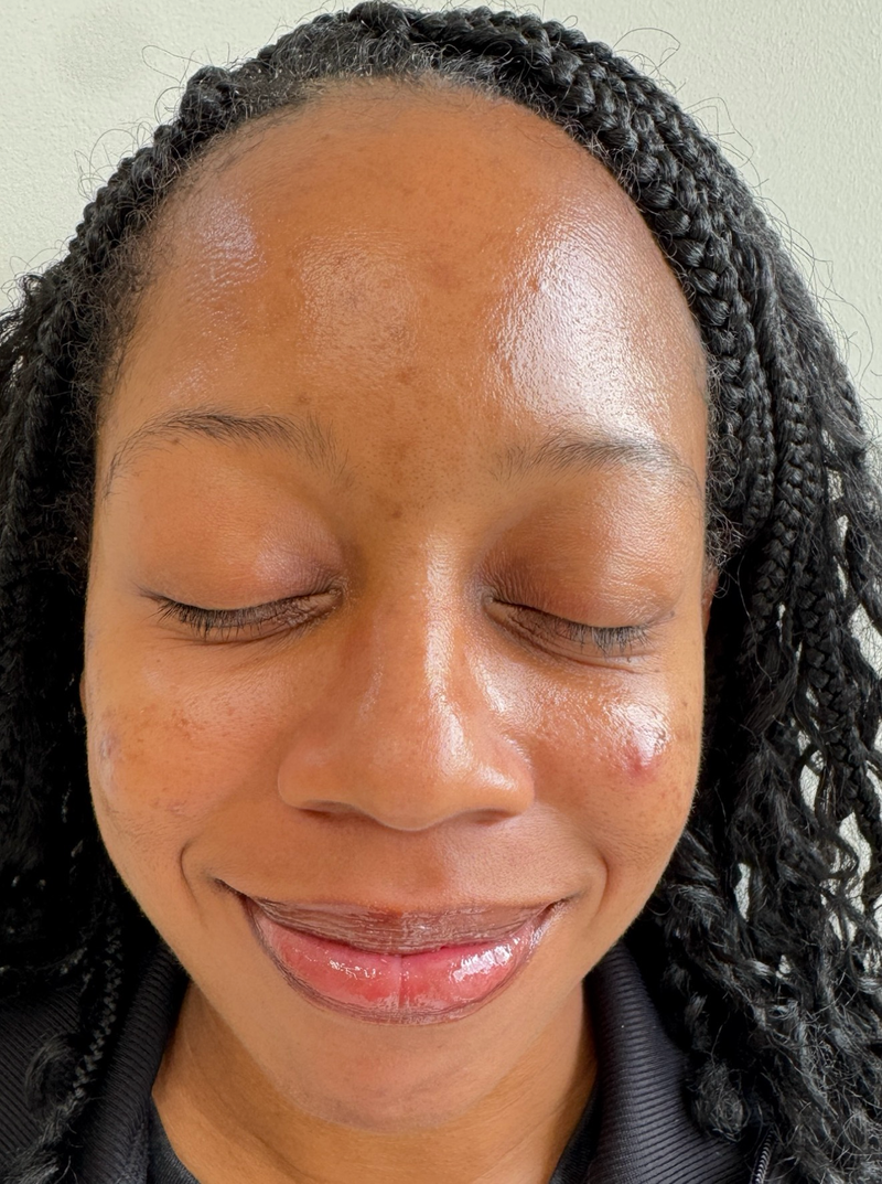 After treatment