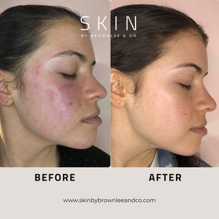 Barrier Calming Moisturizer - Soothing Treatment Cream for Sensitive Skin | Wholesale