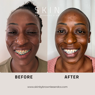 Radiant Renewal A - Retinol Serum for Anti Aging & Texture