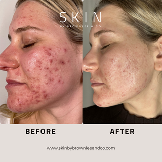 Radiant Renewal HA - Hyaluronic Acid Hydrating Serum | Wholesale