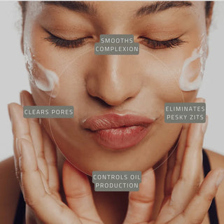 Breakout Banisher Overnight Treatment Gel 10 (formerly blemish chaser 10)